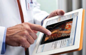 Carestream