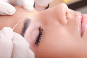 micro botox