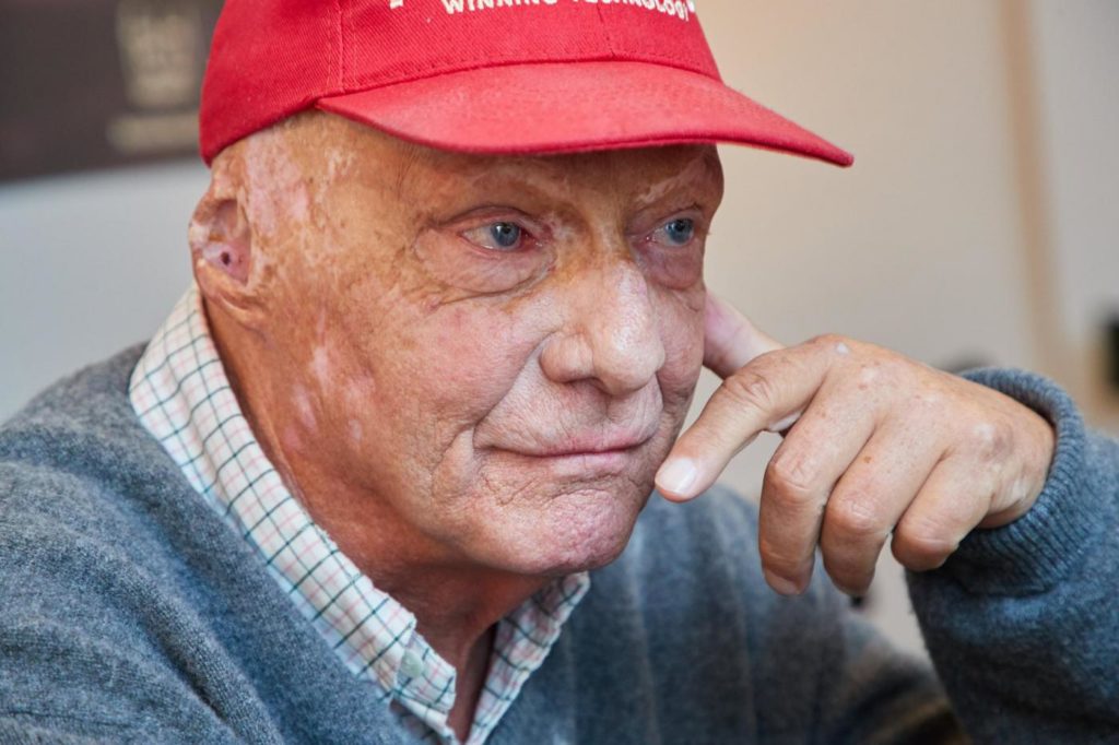 Niki Lauda