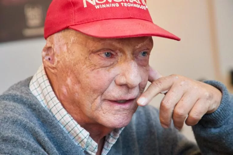 niki lauda