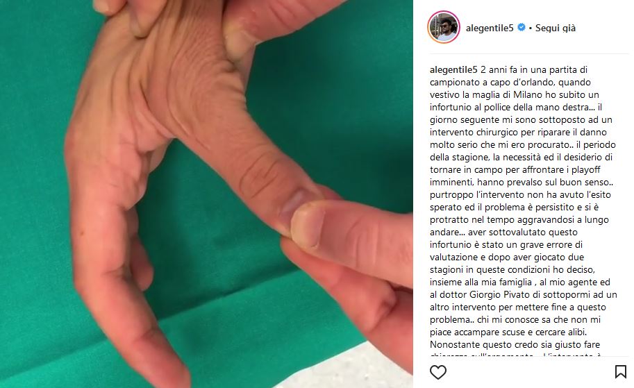 Alessandro Gentile operazioni