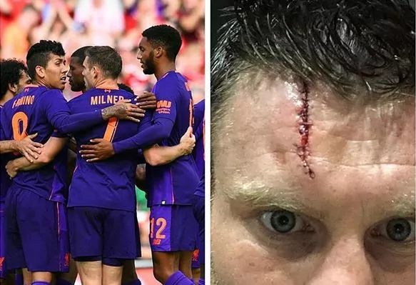 James Milner cicatrice 15 punti di sutura scontro Mario Rui