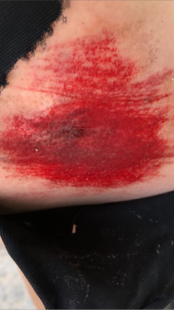 incidente in bici per loris baz