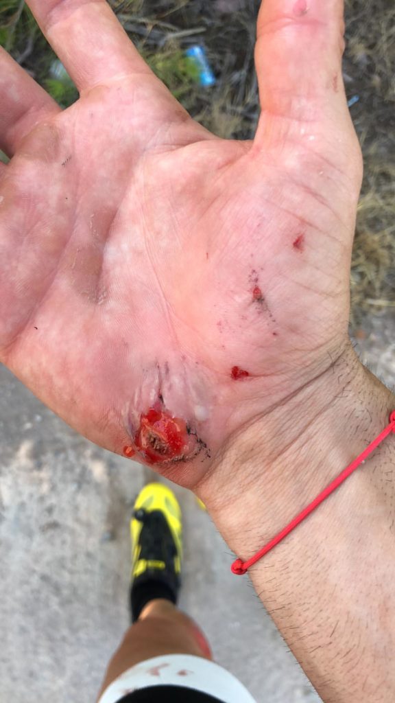 incidente in bici per loris baz