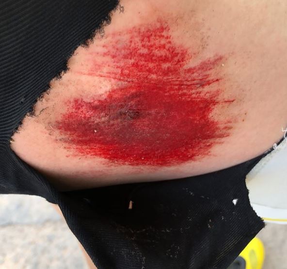 incidente in bici per loris baz