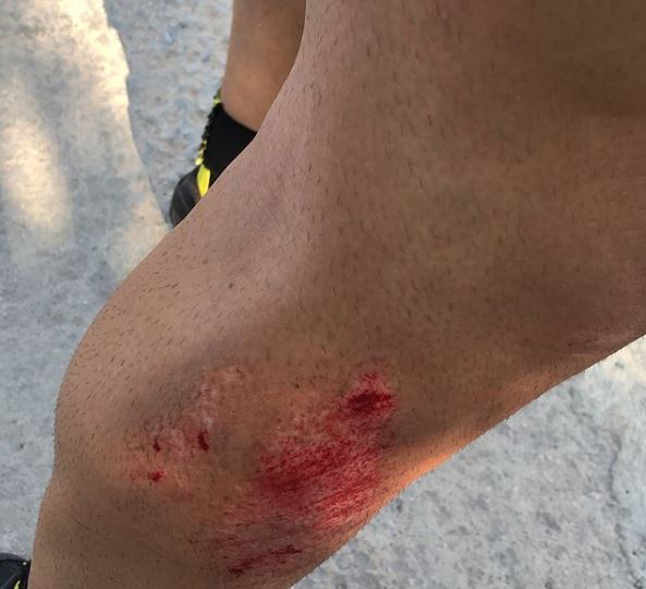 incidente in bici per loris baz