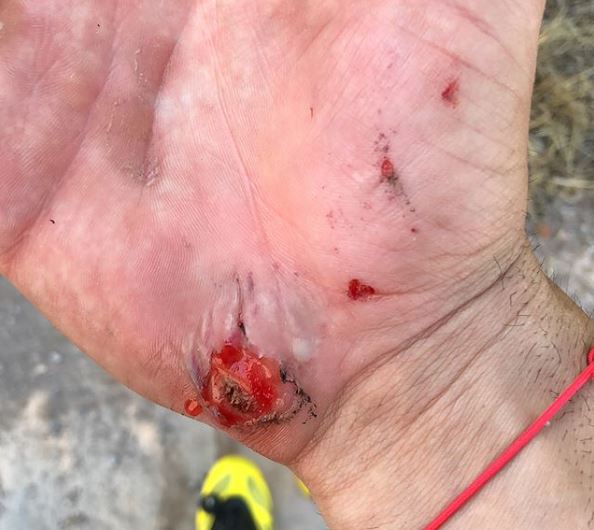 incidente in bici per loris baz
