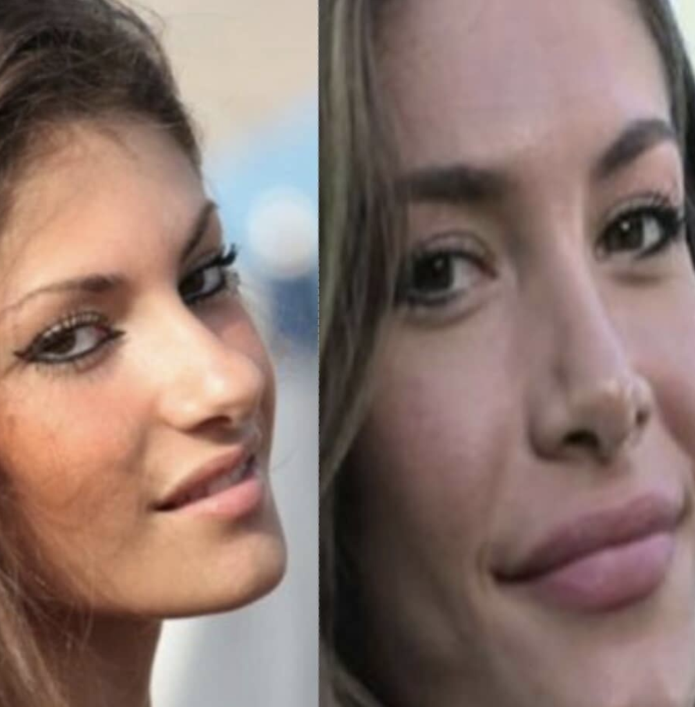mara fasone prima e dopo 2