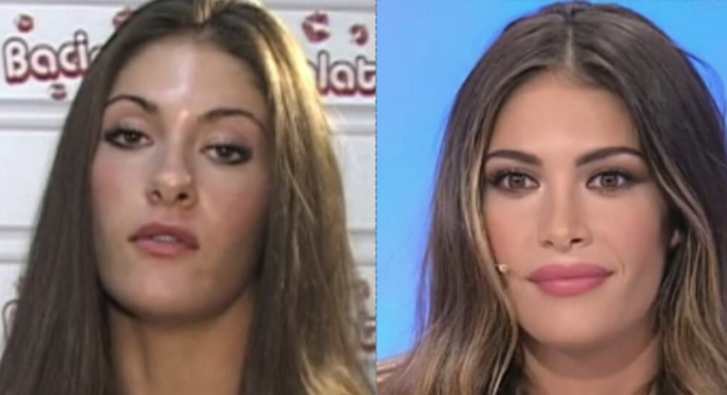 mara fasone prima e dopo 2