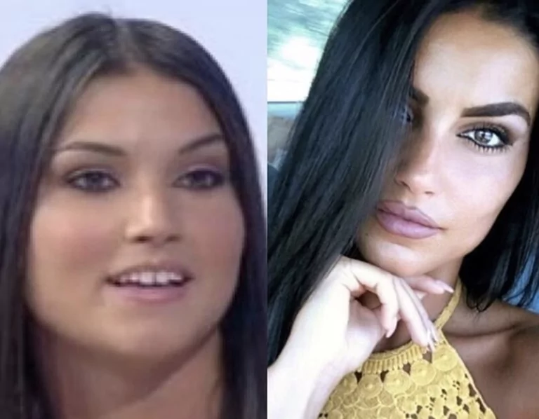 teresa langella prima e dopo