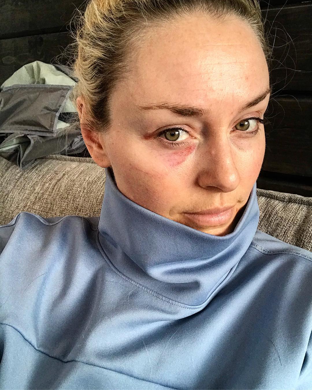 Instagram @lindseyvonn