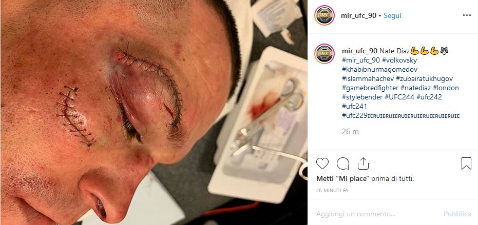Nate Diaz ferite Jorge Masvidal