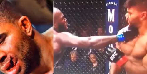 Alistair Overeem labbro