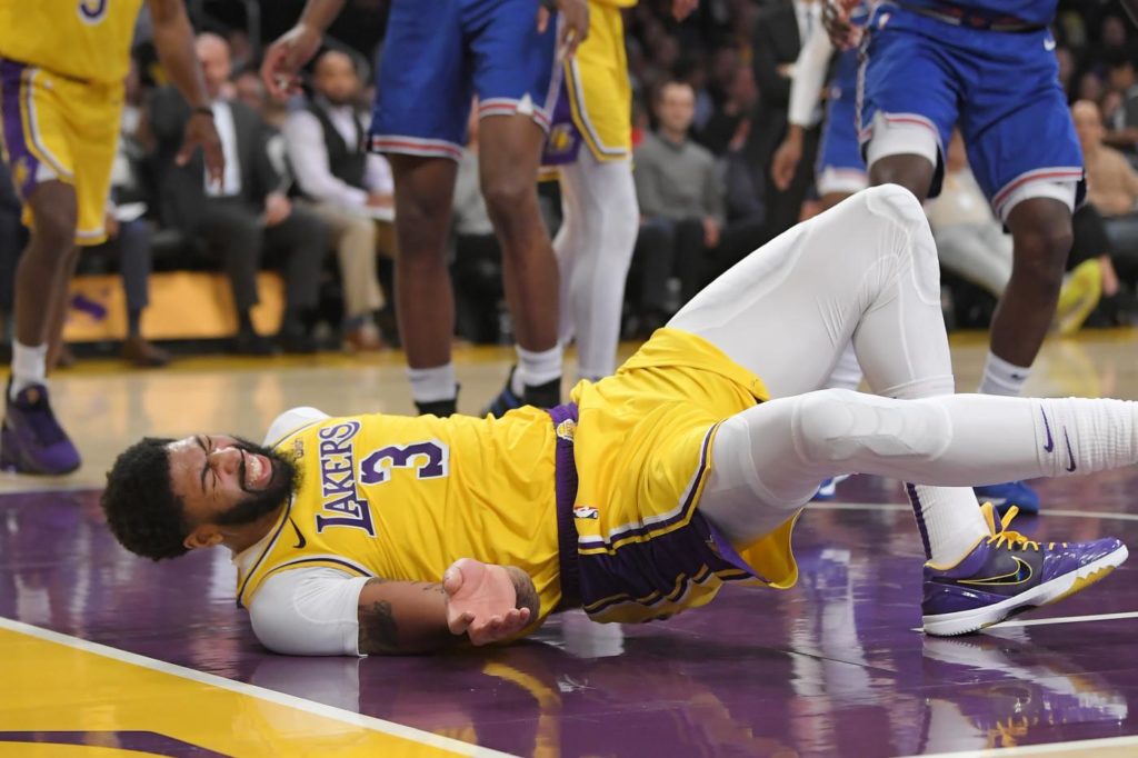 anthony davis lakers