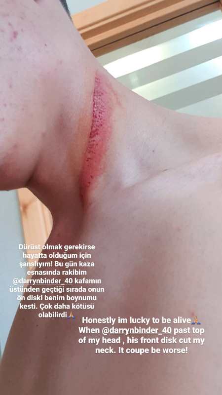 taglio sul collo oncu moto3