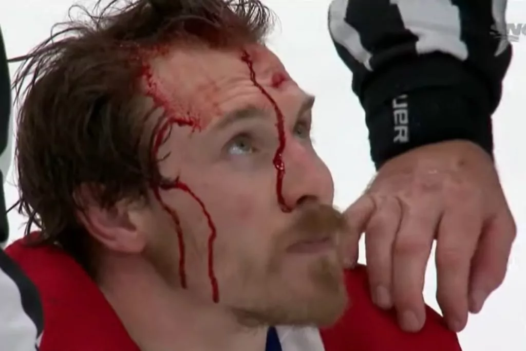 Brendan Gallagher
