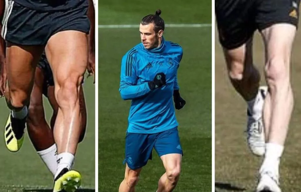 Bale