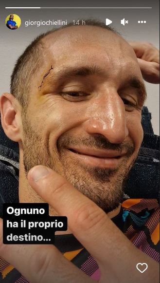 chiellini