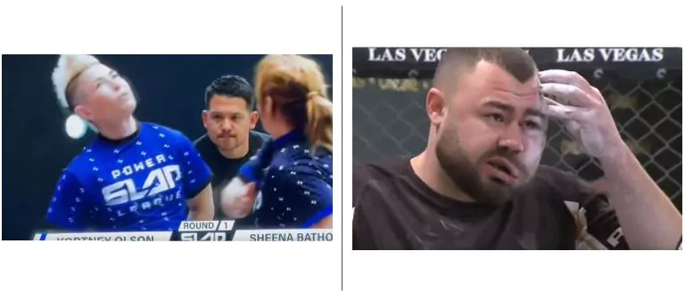 campionato schiaffi